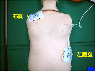 電極パッドに貼り付け位置